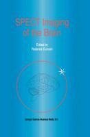 SPECT Imaging of the Brain