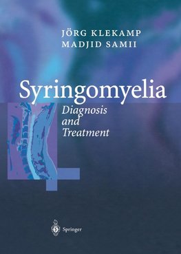 Syringomyelia