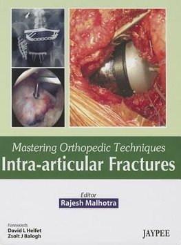 Mastering Orthopedic Techniques