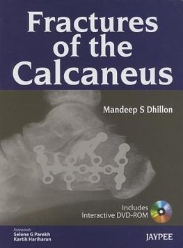 Fractures of the Calcaneus