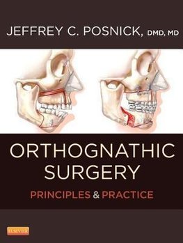 Posnick, J: Orthognathic Surgery/2 Bde.