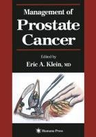 Management of Prostate Cancer