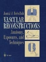 Vascular Reconstructions
