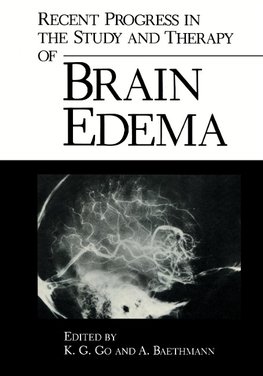 Recent Progress in the Study and Therapy of Brain Edema
