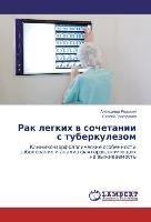 Rak legkih w sochetanii s tuberkulezom
