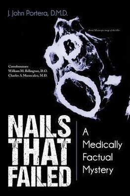 Nails That Failed