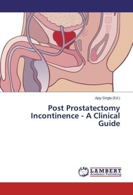 Post Prostatectomy Incontinence - A Clinical Guide