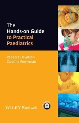 Hands-on Guide to Paediatrics