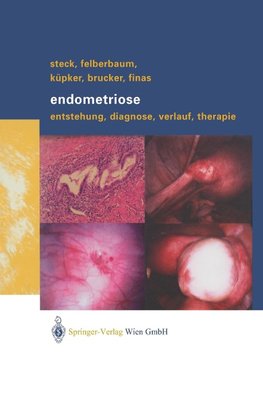 Endometriose