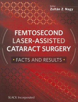 Femtosecond Laser-Assisted Cataract Surgery