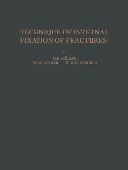 Technique of Internal Fixation of Fractures