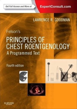 Felson's Principles of Chest Roentgenology