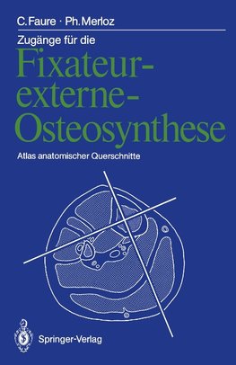 Zugänge für die Fixateur-externe-Osteosynthese