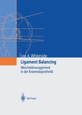Ligament Balancing