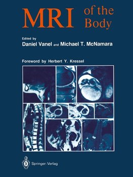 MRI of the Body