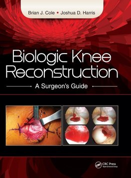 Biologic Knee Reconstruction
