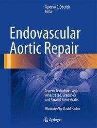 Endovascular Aortic Repair