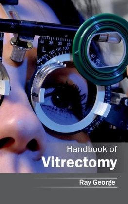 Handbook of Vitrectomy