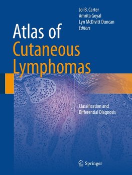 Atlas of Cutaneous Lymphomas