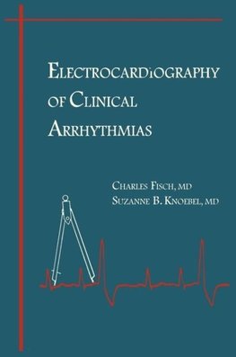 Electrocardiography Clinical Arrhythmias