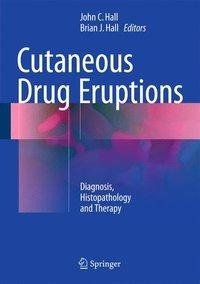 Cutaneous Drug Eruptions