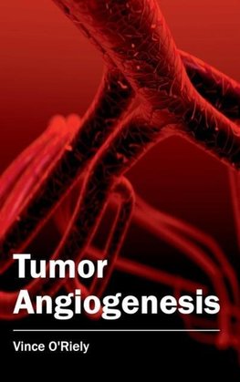 Tumor Angiogenesis