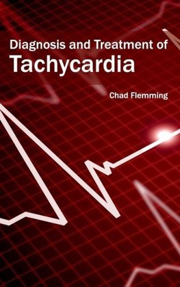 Diagnosis and Treatment of Tachycardia