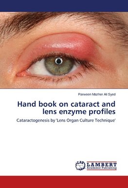 Hand book on cataract and lens enzyme profiles