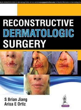 Reconstructive Dermatologic Surgery