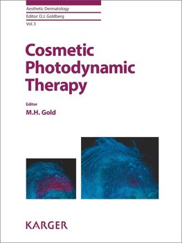 Cosmetic Photodynamic Therapy