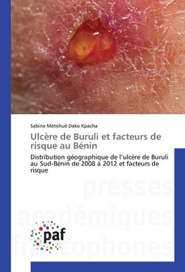 Ulcère de Buruli et facteurs de risque au Bénin