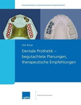 Dentale Prothetik - begutachtete Planungen, therapeutische Empfehlungen