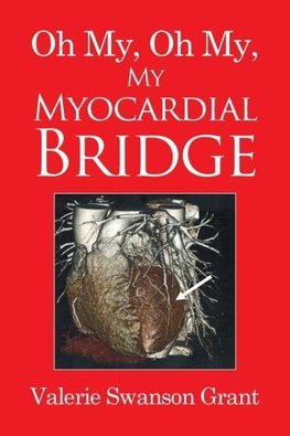 Oh My, Oh My, My Myocardial Bridge