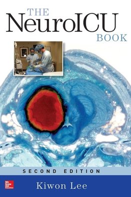 The NeuroICU Book, Second Edition