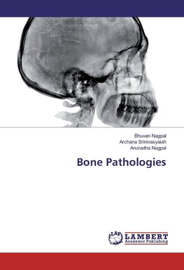 Bone Pathologies