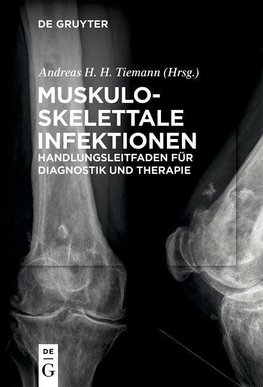 Muskuloskelettale Infektionen