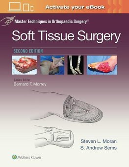 Master Techniques in Orthopaedic Surgery: Soft Tissue Surgery (Master Techniques in Orthopaedic Surgery)