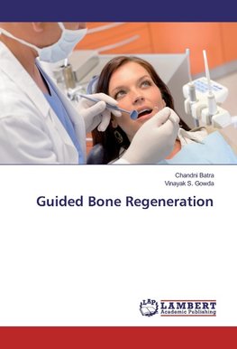 Guided Bone Regeneration