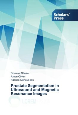 Prostate Segmentation in Ultrasound and Magnetic Resonance Images