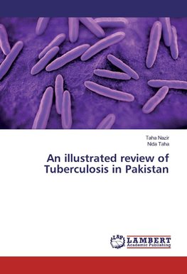 An illustrated review of Tuberculosis in Pakistan