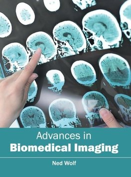 Advances in Biomedical Imaging