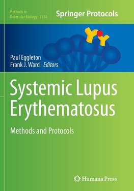 Systemic Lupus Erythematosus