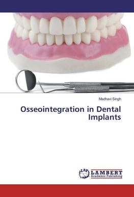 Osseointegration in Dental Implants