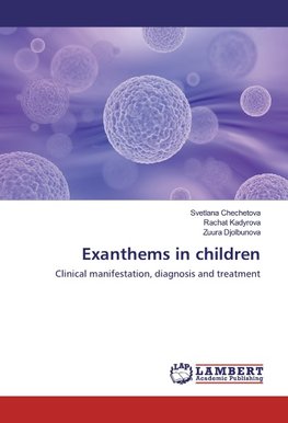 Exanthems in children