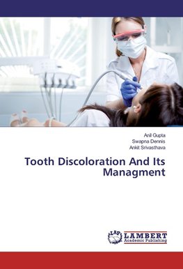 Tooth Discoloration And Its Managment