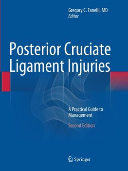 Posterior Cruciate Ligament Injuries
