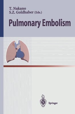 Pulmonary Embolism