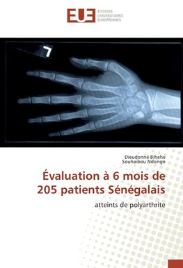 Évaluation à 6 mois de 205 patients Sénégalais