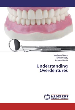 Understanding Overdentures