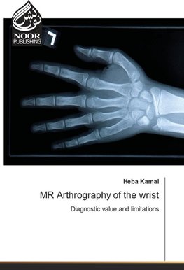 MR Arthrography of the wrist